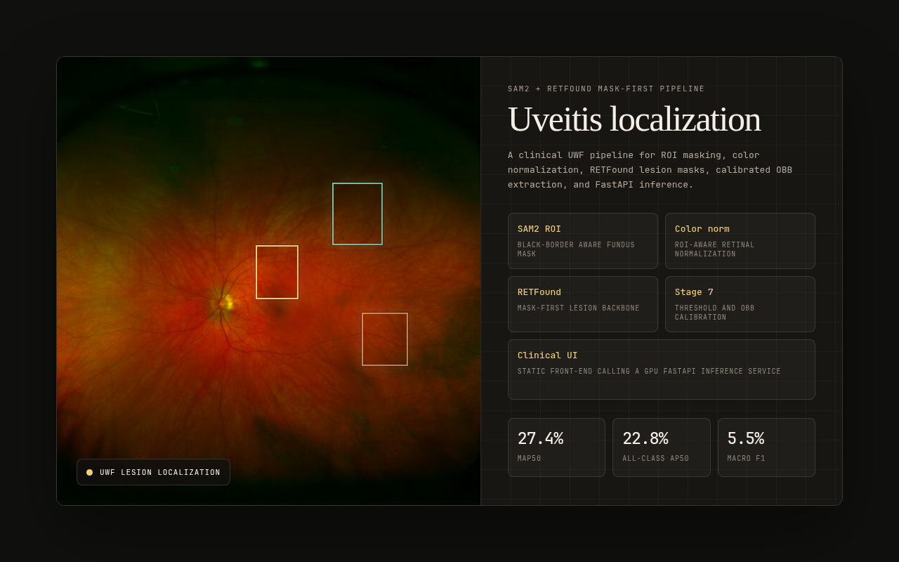 Uveitis localization pipeline preview